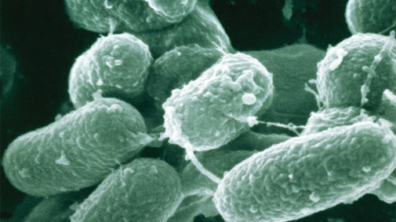 One study compares assays for the detection of TB and drug-resistant TB.