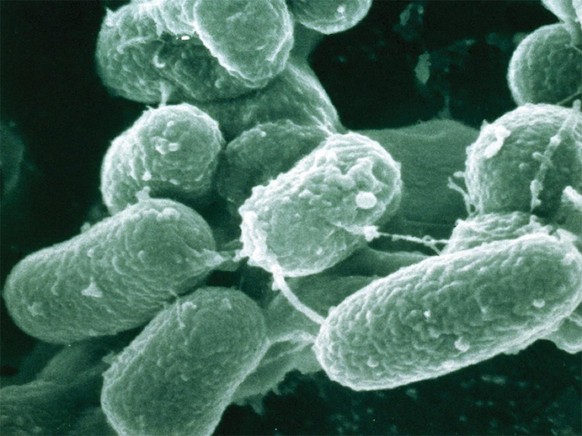 One study compares assays for the detection of TB and drug-resistant TB.