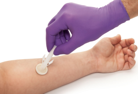 Desinfección de la piel del paciente con el antiséptico cutáneo BD ChloraPrep™