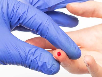 Medical director’s views on needlestick injury protection
