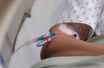 PICC lines for TPN may offer certain advantages over CVCs