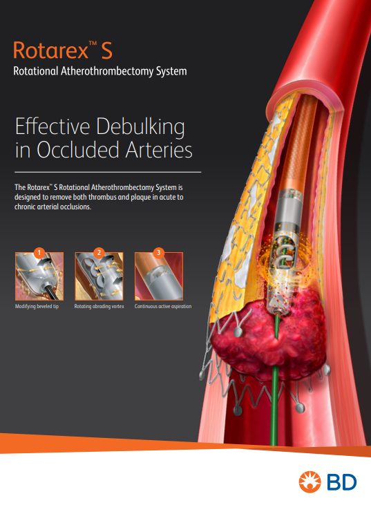 Rotarex Clinical Brochure