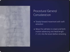 Exploration of technique