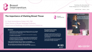 The Importance of Marking Breast Tissue