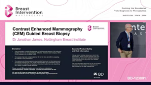 CEM guided breast biopsy as an alternative to MRI biopsy