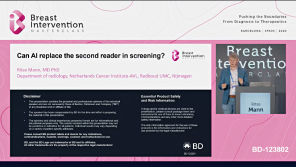 Can AI Replace the second reader in screening?