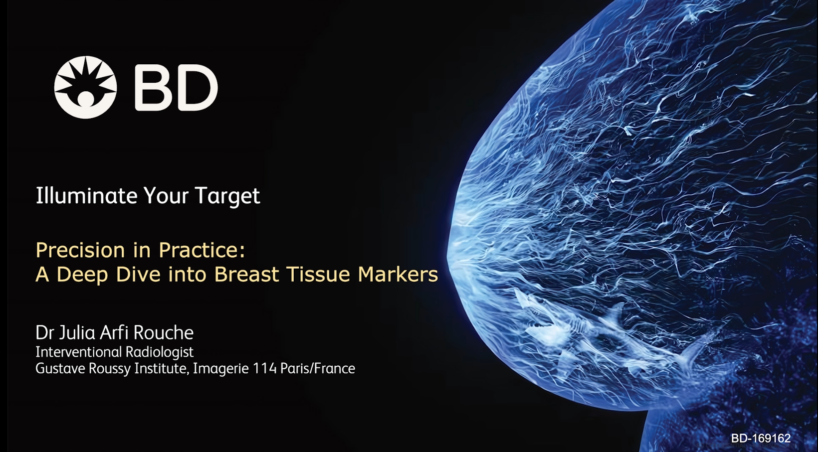 Markers Webinar - Precision in Practice: A Deep Dive into Breast Tissue Markers