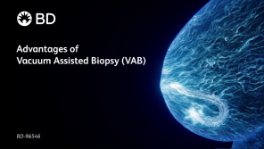 Advantages of Vacuum Assisted Biopsy (VAB)
