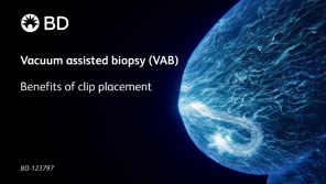 Vacuum assisted biopsy (VAB) Benefits of clip placementExploration of technique