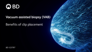 Vacuum assisted biopsy (VAB) Benefits of clip placement