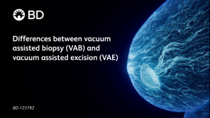 Differences between vacuum assisted biopsy (VAB) and vacuum assisted excision (VAE)