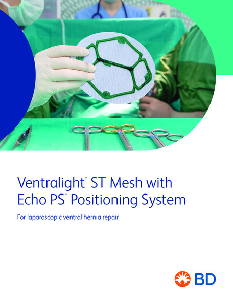 Ventralight ST EchoPS