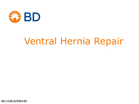Ventral-Hernia-Repair
