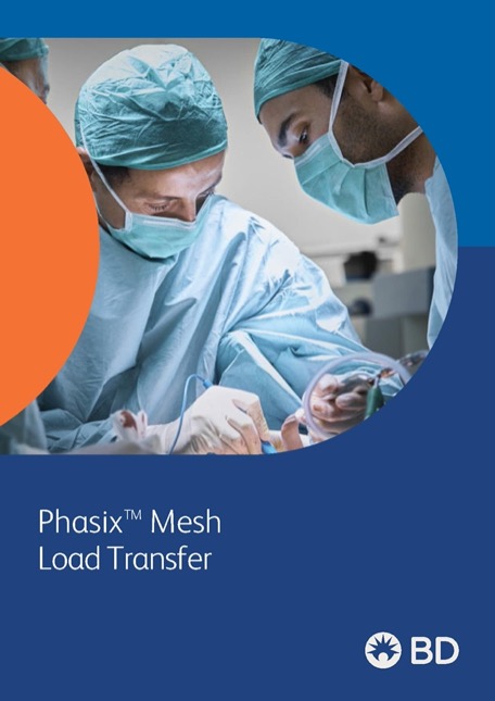 Phasix Transfer of load Transfer