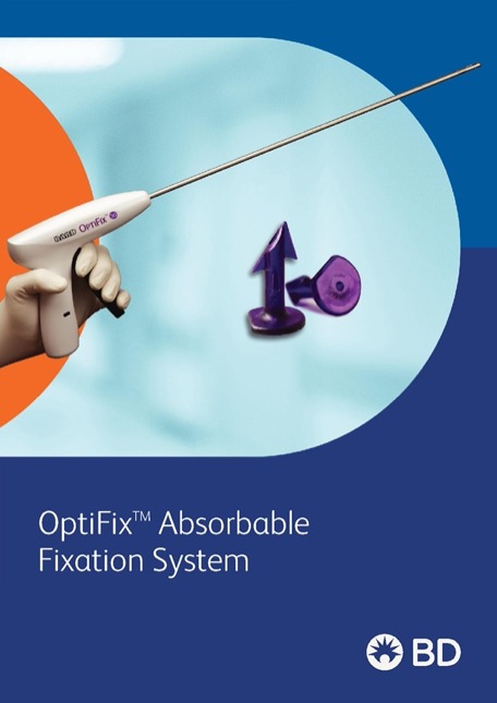 Optifix Bochure