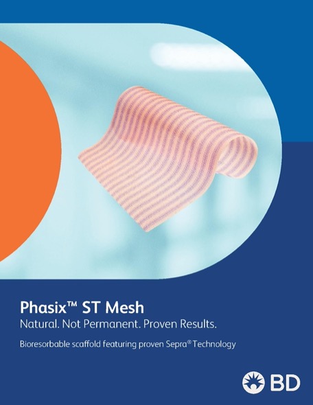 Phasix ST Brochure