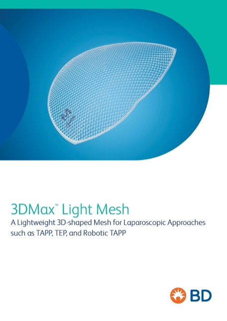 3D Max Light Mesh